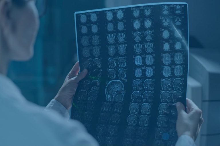 O “Efeito Sanduíche” no Diagnóstico por Imagem: Como proteger sua clínica da pressão das operadoras e da alta de custos
